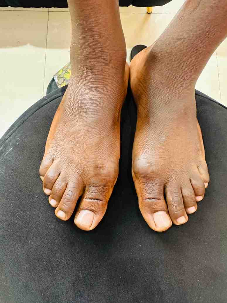 Pedicure